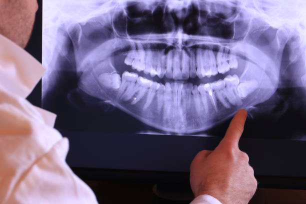 Best Pediatric Emergency Dentist in West Park, NJ